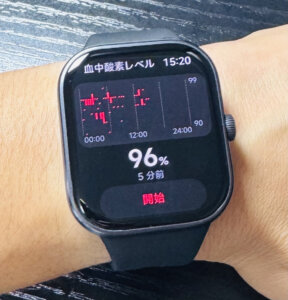 Redmi Watch 5シャオミスマートウォッチ