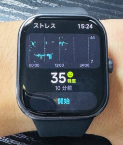 Redmi Watch 5シャオミスマートウォッチ